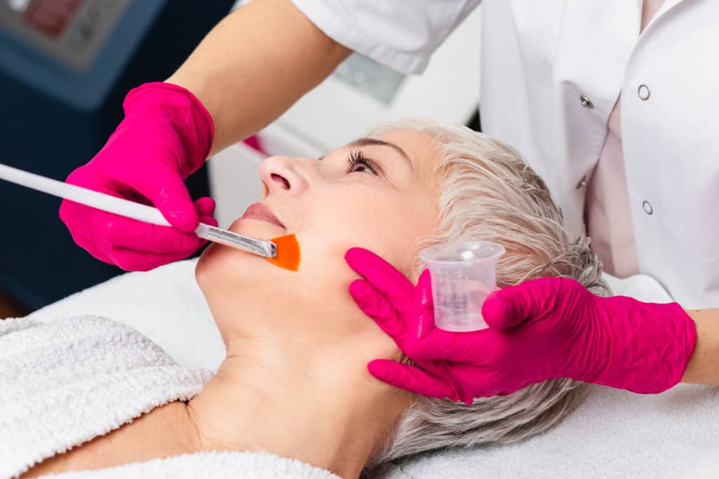 Chemical Peel | South Ogden, UT | Timeless Med Spa