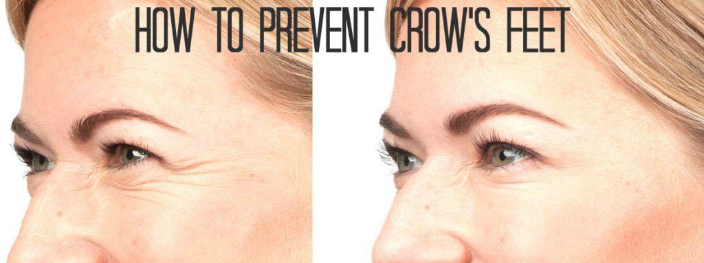 How to-prevent-crows-feet | South Ogden, UT | Timeless Med Spa