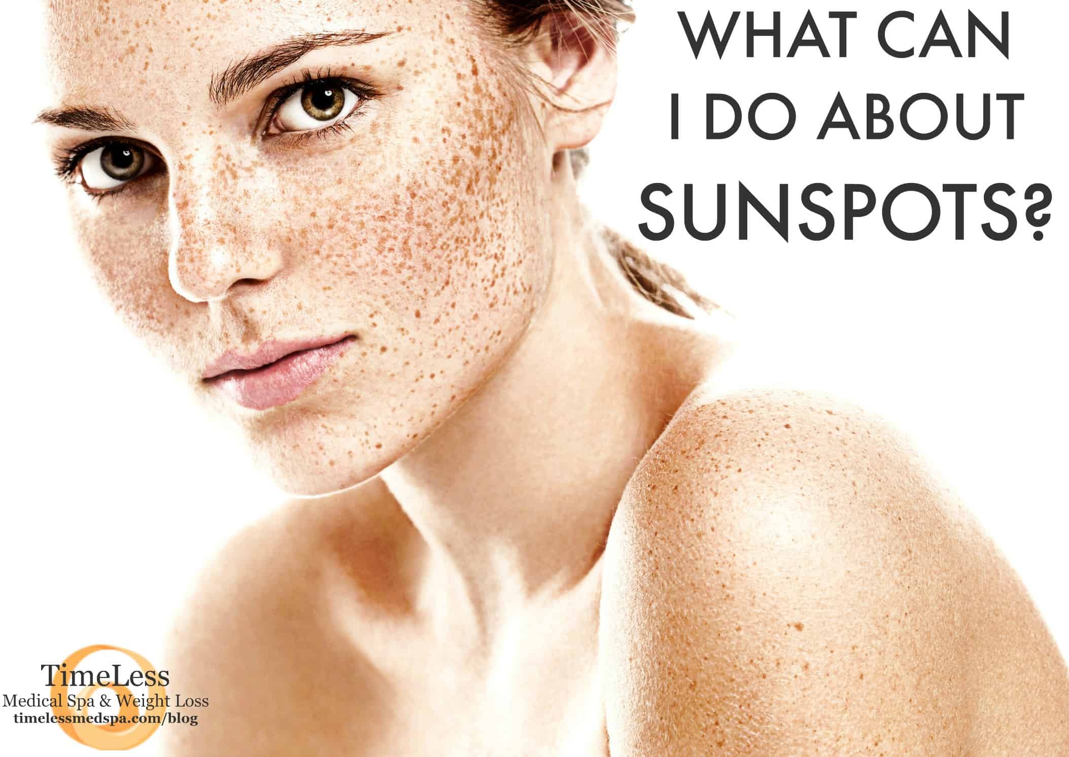 What Can I Do About Sunspots? | South Ogden, UT | Timeless Med Spa