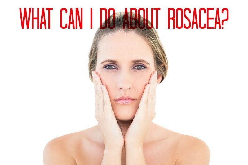 What Can I do about Rosacea? | South Ogden, UT | Timeless Med Spa