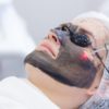 Laser Carbon Facial Test | South Ogden, UT | Timeless Med Spa