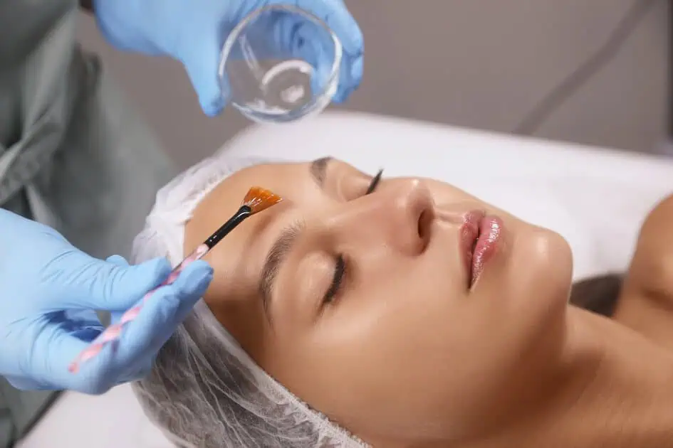 Chemical Peels by Timeless Medical Spa and Weight Loss in South Ogden, UT